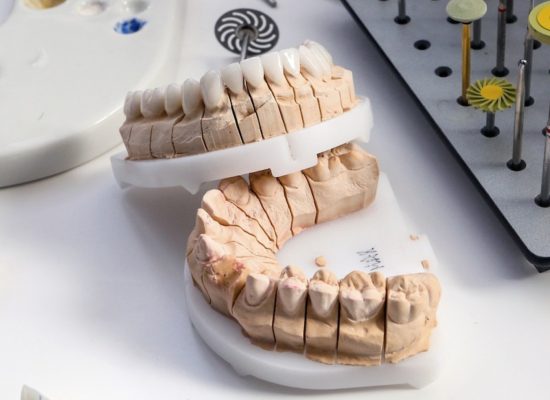 Corregir apiñamiento dental