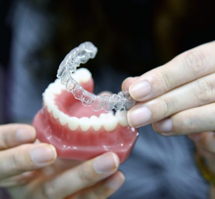 Invisalign-ortodoncia invisible