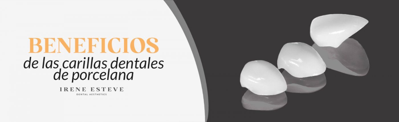 beneficios de las carillas dentales de porcelana
