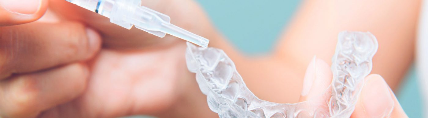 blanqueamiento-dental-Irene-Esteve
