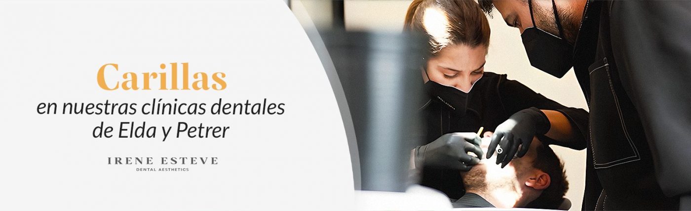 blog-irene-esteve-carillas-en-la-clinica-dental-de-elda-y-petrer
