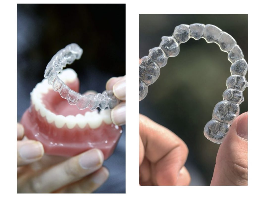 invisalign-irene-esteve