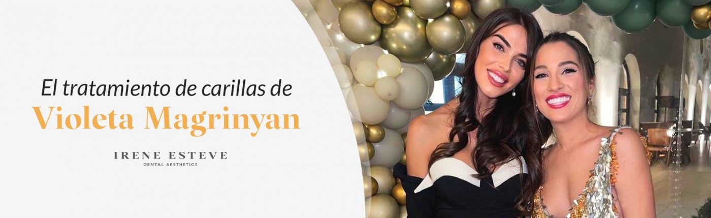 blog-irene-esteve-el-tratamiento-de-carillas-de-violeta-magrinyan