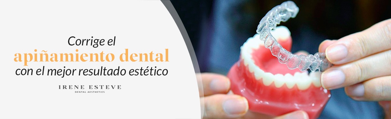 corrige-apiñamiento-dental-con-el-mejor-resultado-estetico