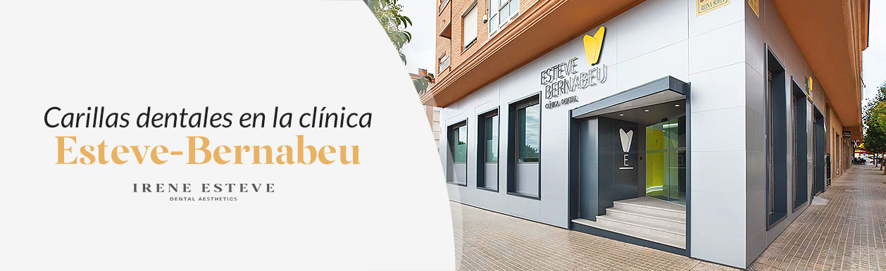 carillas-dentales-clinica-irene-esteve-petrer