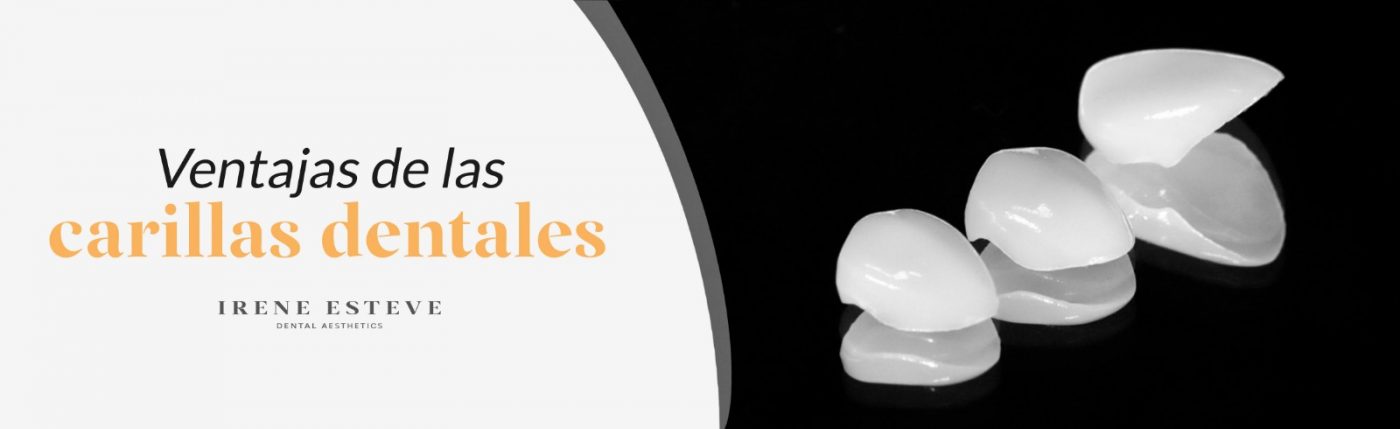 ventajas-carillas-dentales-irene-esteve