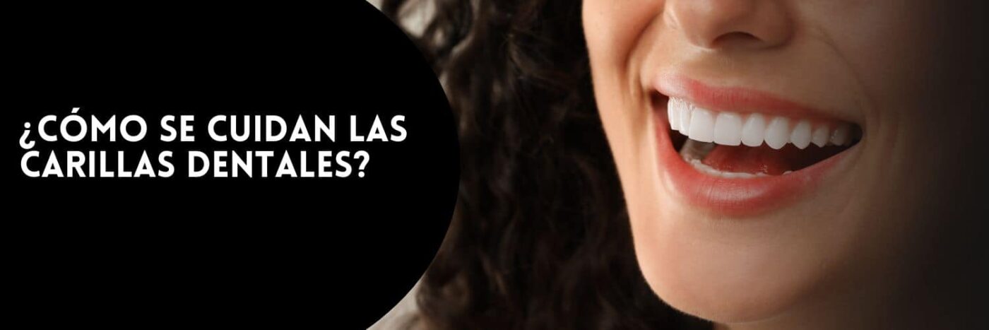 Cómo se cuidan las carillas dentales