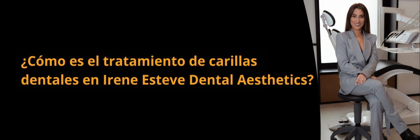 como-es-el-tratamiento-de-carillas-dentales-en-Irene-esteve
