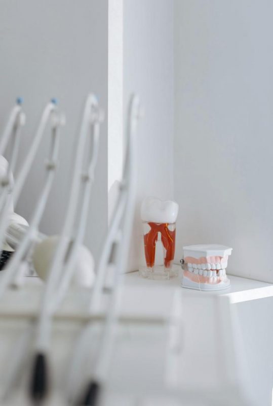 irene-esteve-blanqueamiento-dental