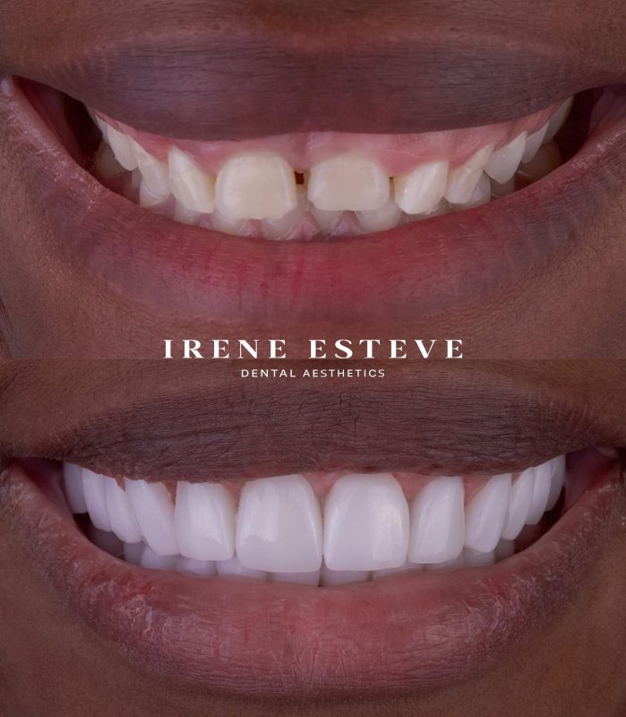 Irene Esteve Aesthetics experto en estética dental