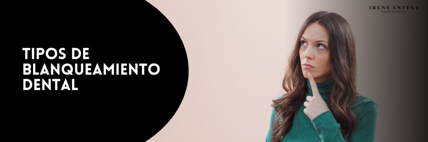 Tipos de blanqueamiento dental
