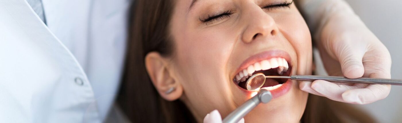 Mejores carillas dentales