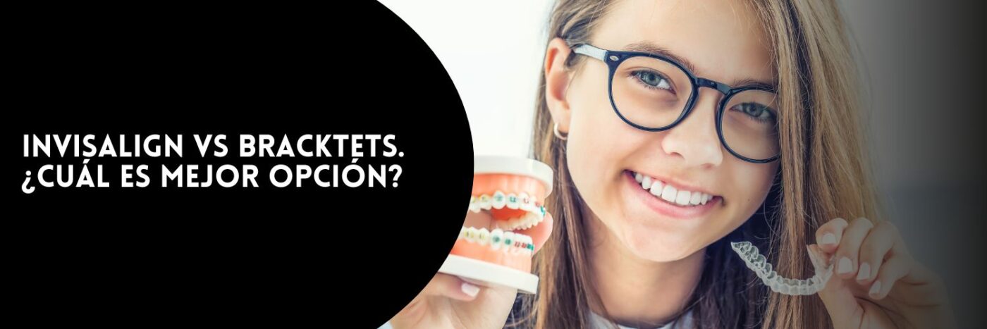 Invisalign o brackets