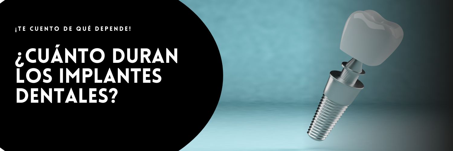 Cuánto duran los implantes dentales
