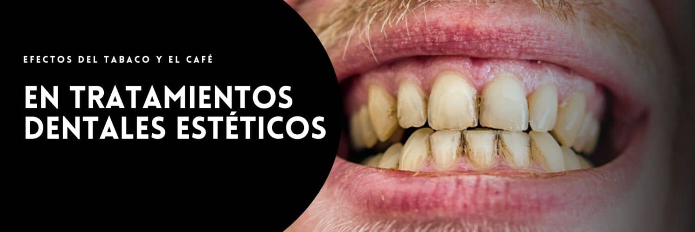 Efectos del café y el tabaco en tratamientos dentales estéticos