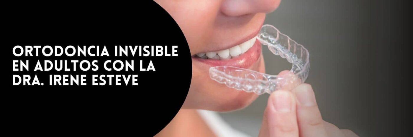 Ortodoncia invisible en adultos