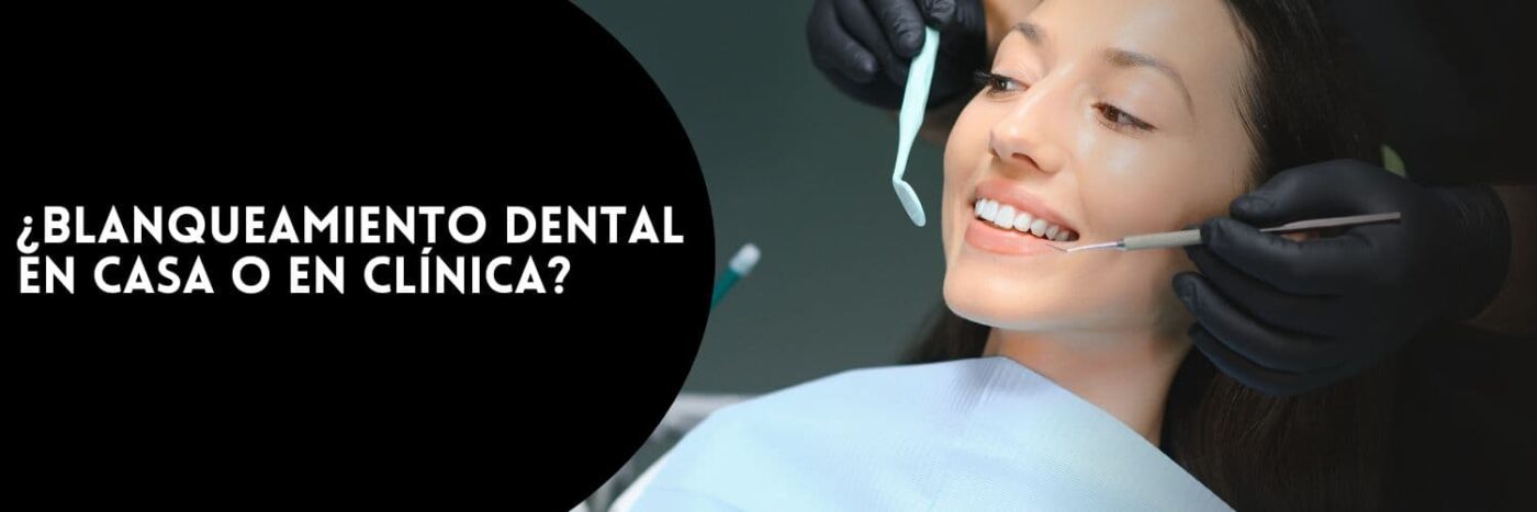 Blanqueamiento dental en casa o en clínica