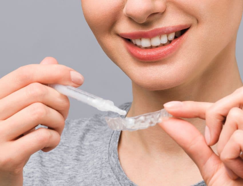 Blanqueamiento dental en casa