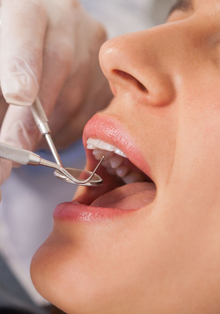Endodoncia microscópica en Alicante